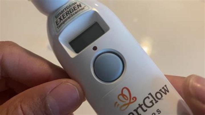 Is SmartGlow Exergen temporal scanner accurate?
