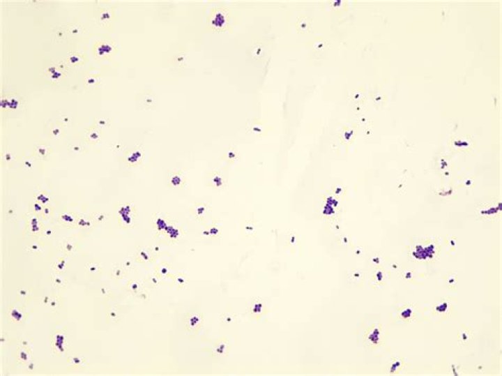 Is Staph aureus Gram-positive or negative?