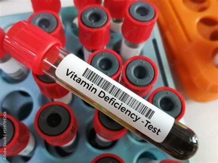 Is there a blood test for vitamin A?
