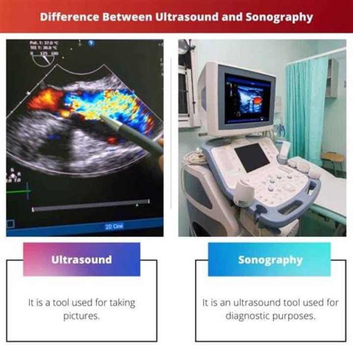 Is there a difference between ultrasound tech and sonography?