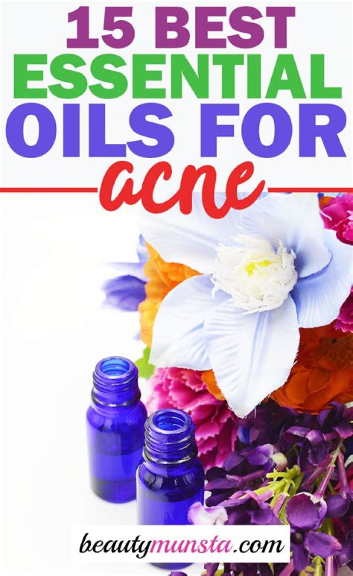 Is there an essential oil for acne?