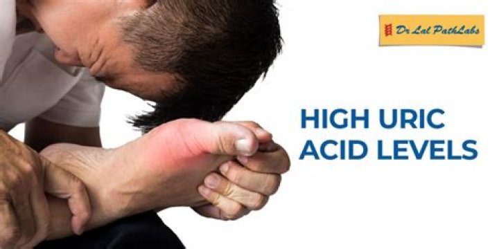 Is uric acid higher in morning?
