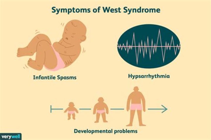 Is West syndrome curable?