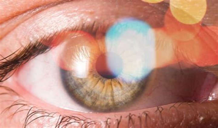 ¿Por que veo destellos en un ojo?