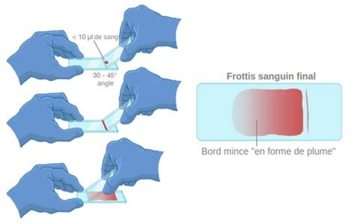 Pourquoi un frottis tous les 3 ans ?