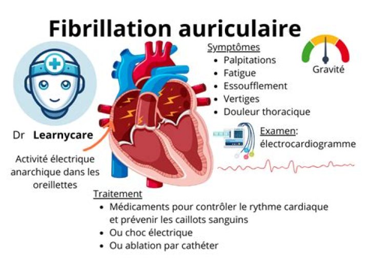 Qu'est-ce qui provoque la fibrillation auriculaire ?