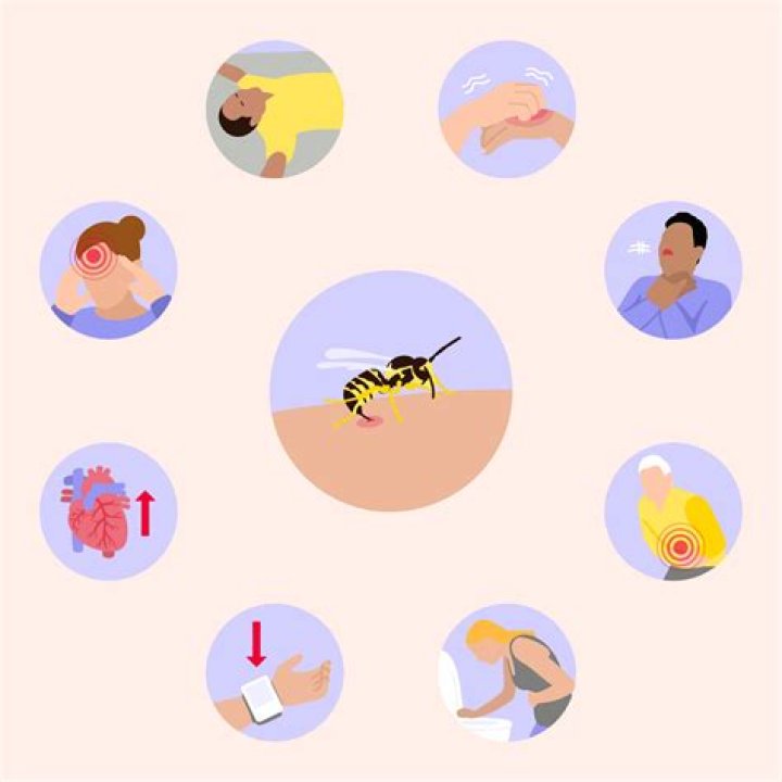 Quand survient le choc anaphylactique ?