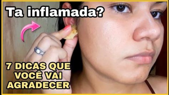 Quanto tempo leva para desinflamar a orelha?