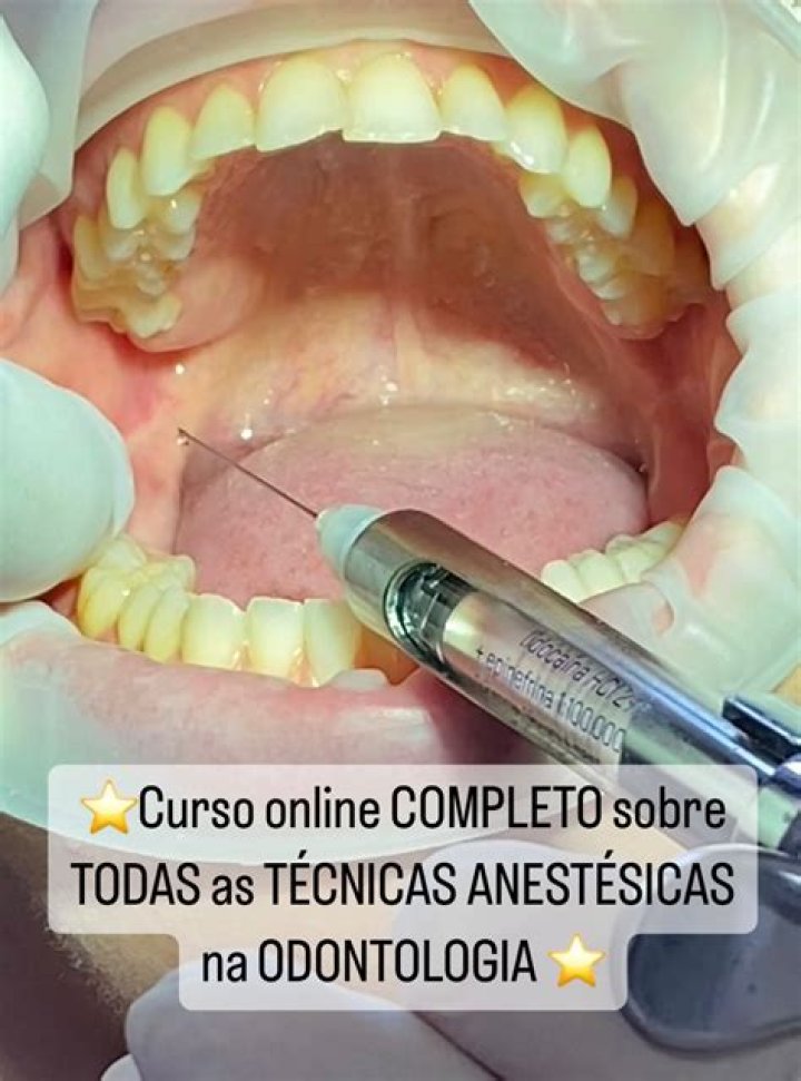 Quem tem arritmia pode tomar anestesia no dentista?