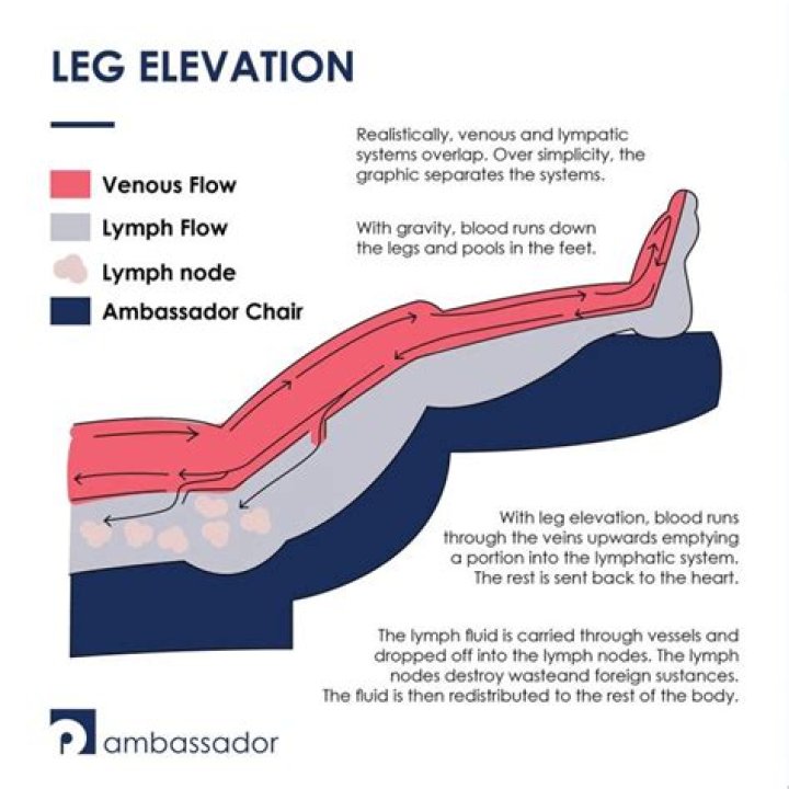 Should I keep my leg elevated with DVT?