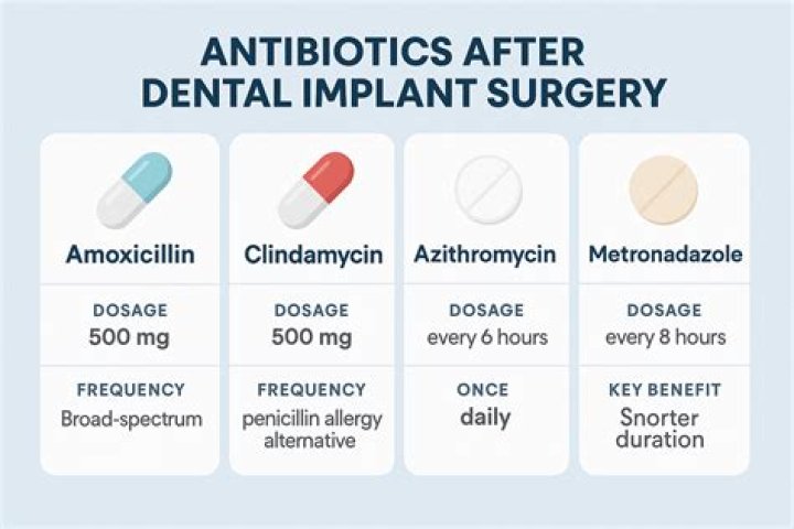 Should you take antibiotics after dental implant?