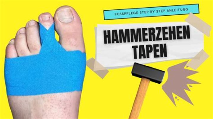 Warum bekommt man einen Hammerzeh?