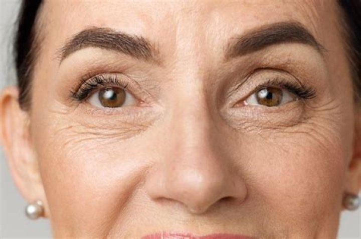 Warum habe ich Falten unter den Augen?