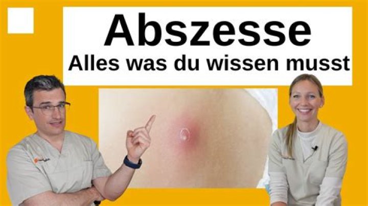 Was ist die Abszisse?