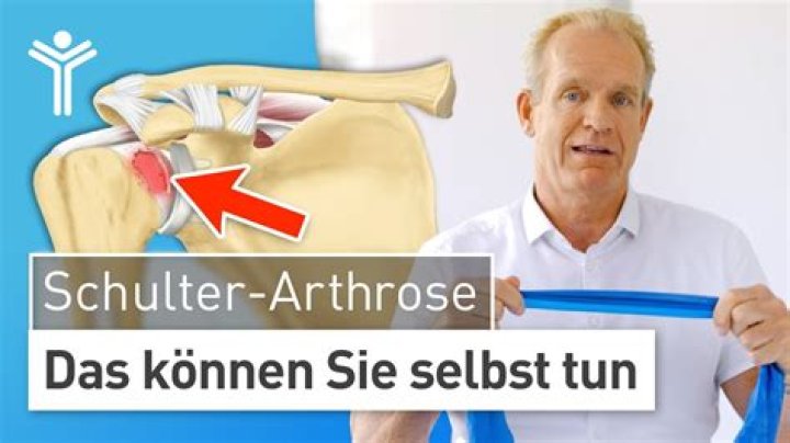 Was tun bei Schultereckgelenksarthrose?