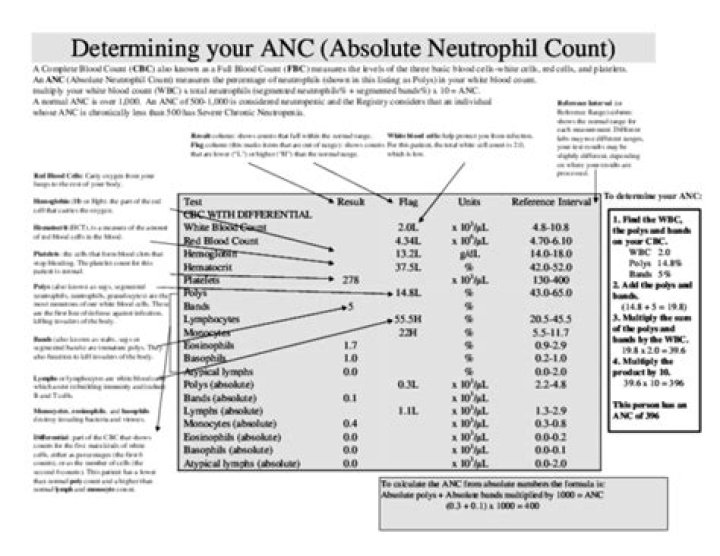 What are bands in ANC?