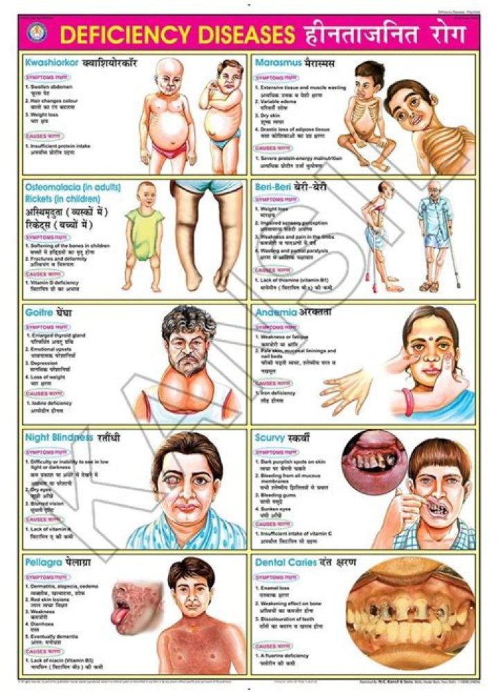What are the 5 major deficiency disorders in the Philippines?