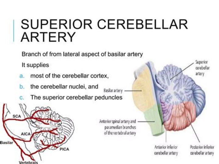 What artery supplies the superior cerebellar peduncle?