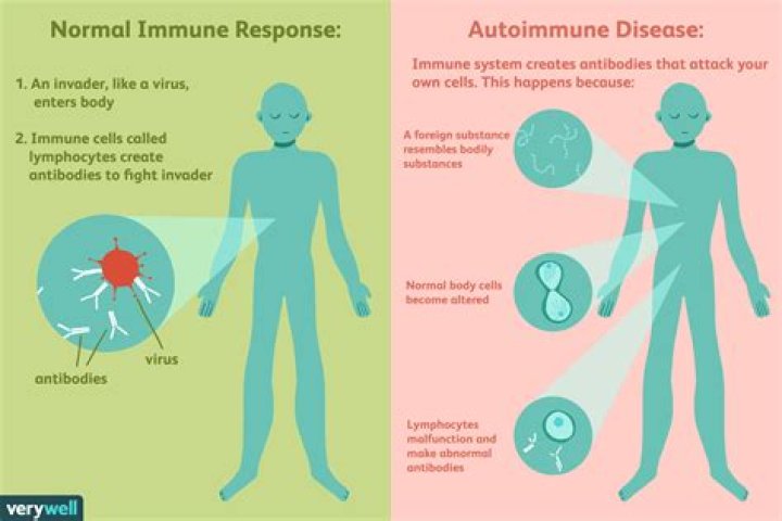 What autoimmune disease causes TMJ?