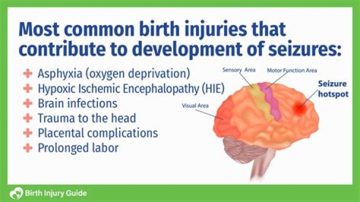 What can cause fetal seizures?