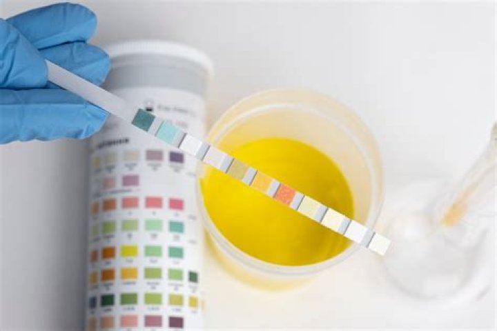 What can dilute hCG in urine?