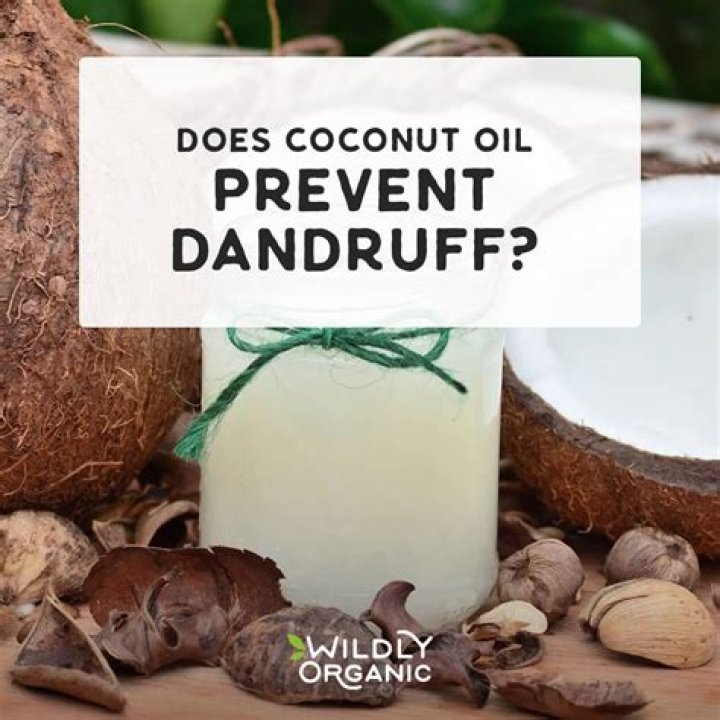 What can I mix with coconut oil for dandruff?