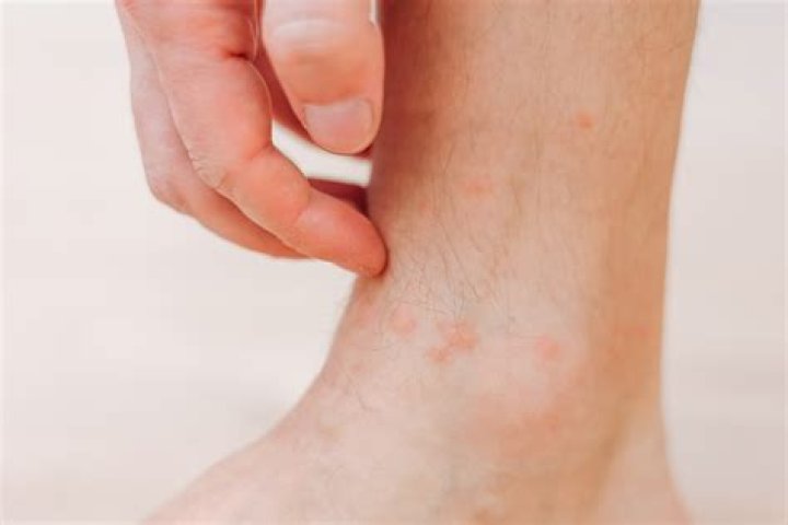 What causes a red bottom?