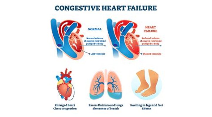 What causes cardiac insufficiency?