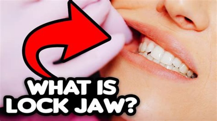 What causes lockjaw when yawning?