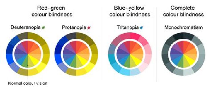 What Colour is or are your eyes?