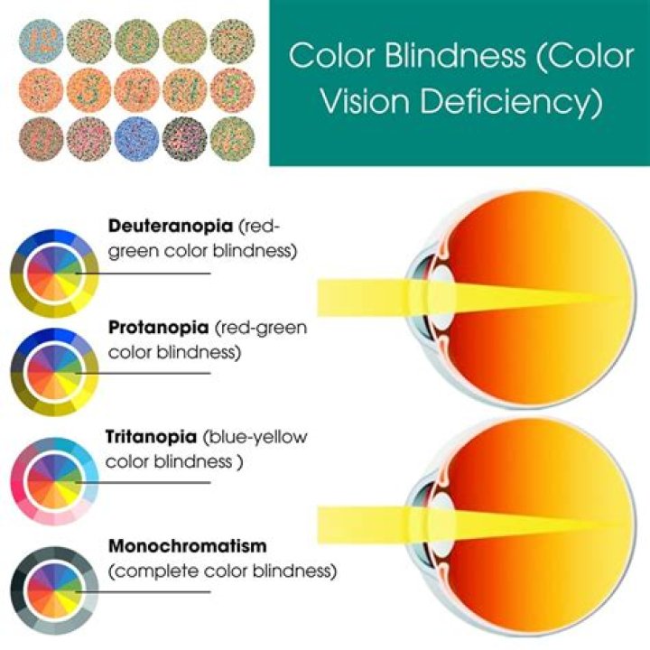 What current research is being done to develop a cure for color blindness?