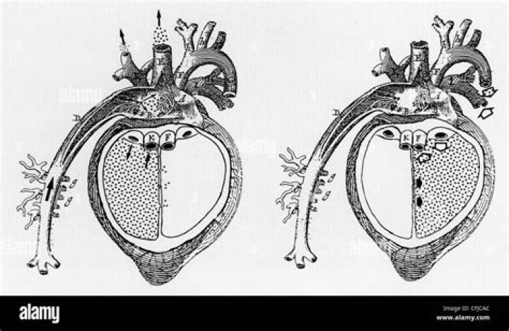 What did Galen discover about the heart?
