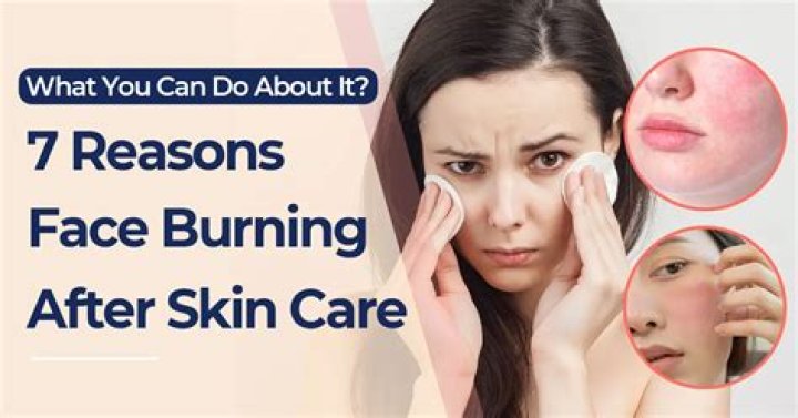 What do you do when your face is burning and red?