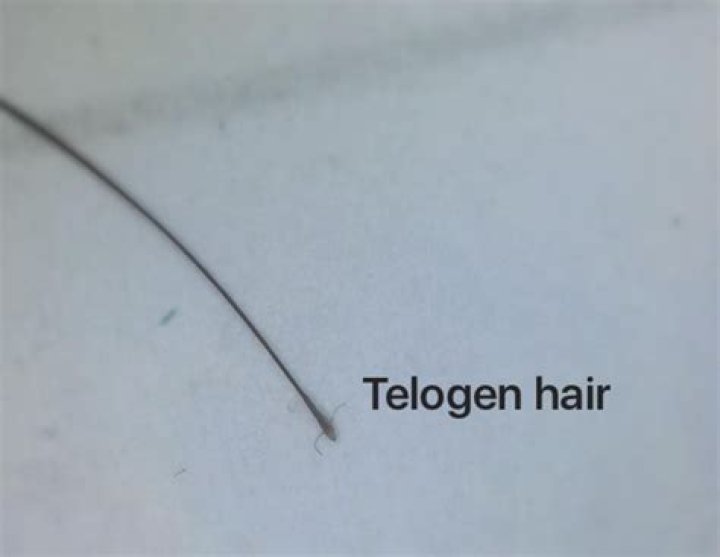 What does a club hair look like?