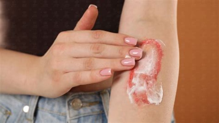 What does caustic do to your skin?