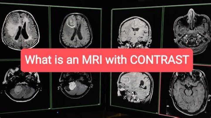 What does contrast enhance on MRI?