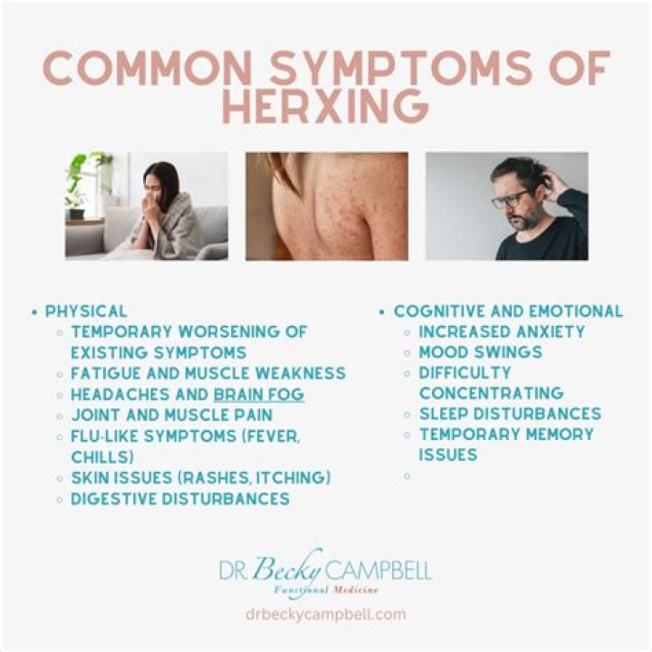What does Herxing feel like?