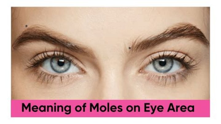 What does it mean if you have purple eyes?