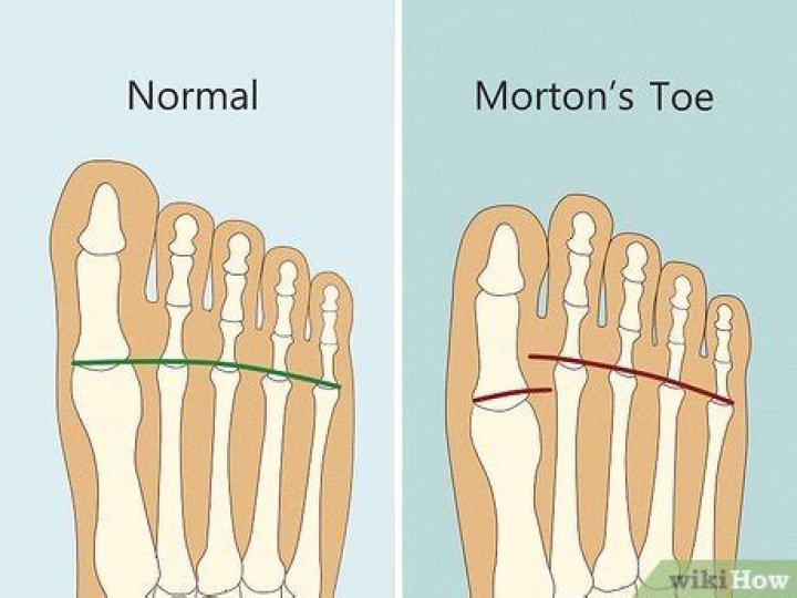 What does it mean to have a longer second toe?
