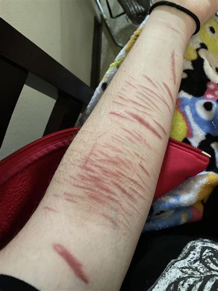 What does it mean when a cut turns purple?