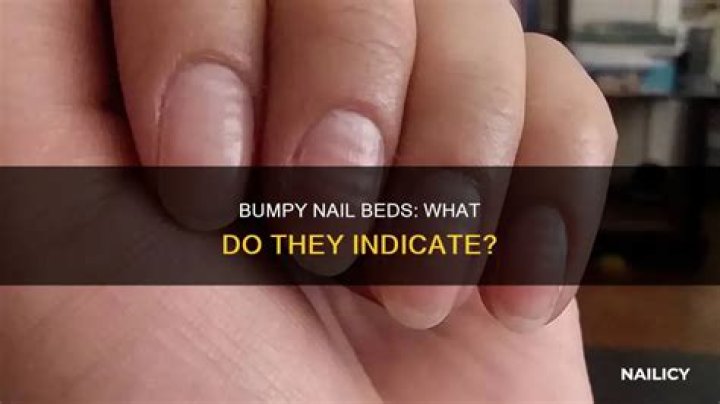 What does it mean when your nail beds are bumpy?