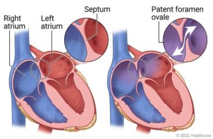 What does Patent mean in radiology?