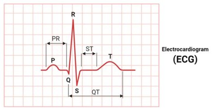 What does the electrocardiogram represent?