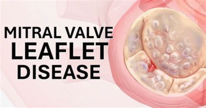 What does thickened mitral valve leaflets mean?