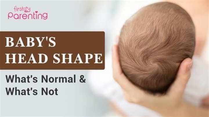 What happens if baby's head is not supported?