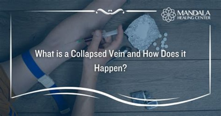 What happens if I accidentally cut a vein?