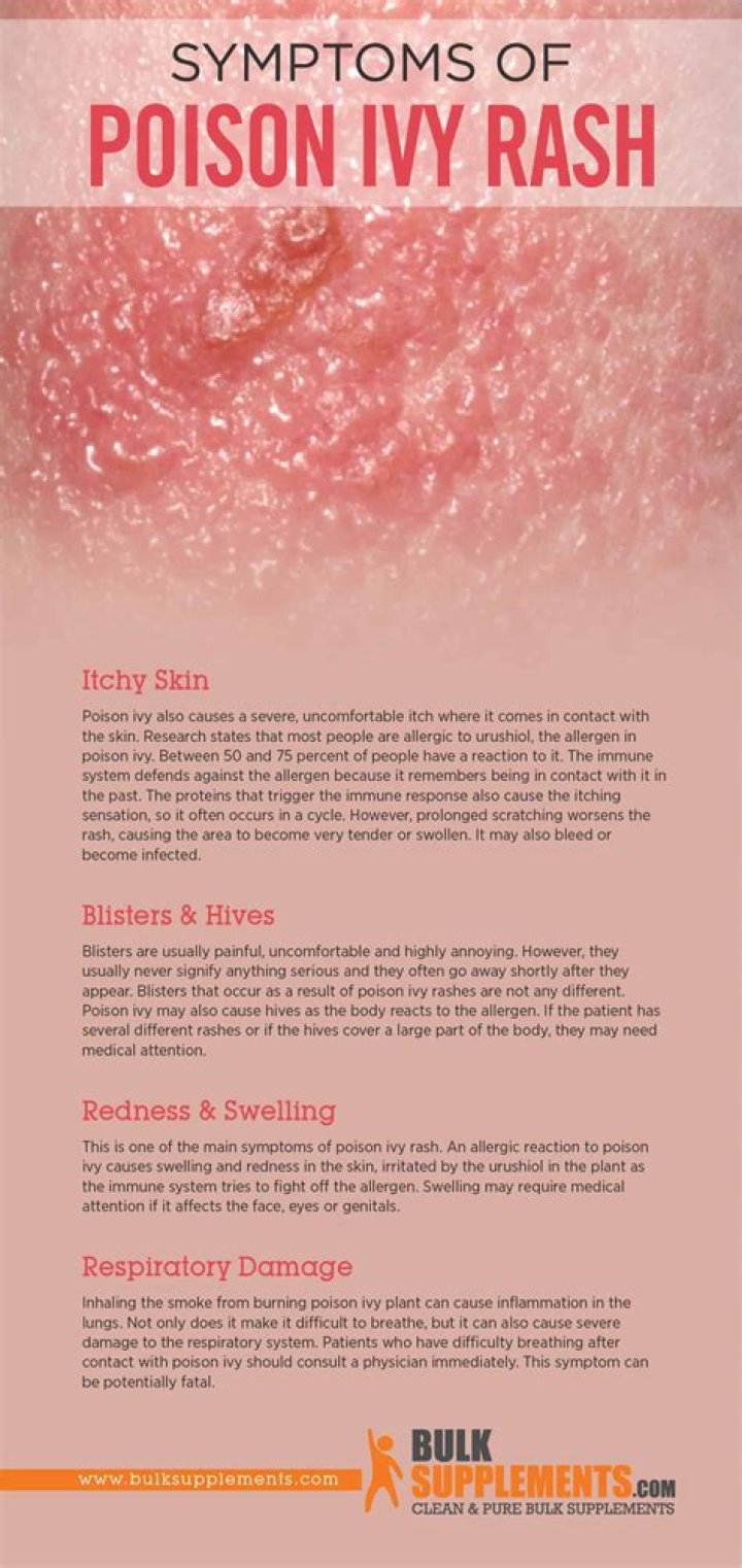 What happens if you breathe poison ivy?