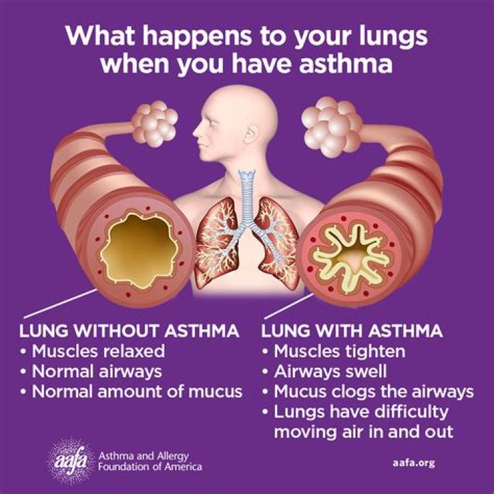 What happens if you develop asthma in the military?