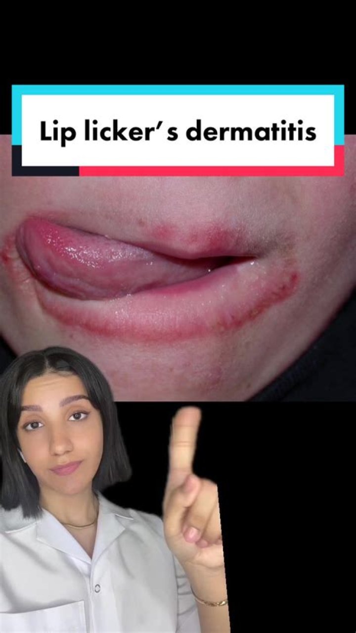 What happens if you eat Lip Smacker?