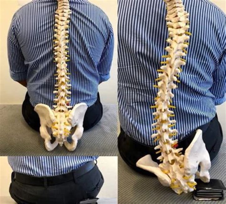 What happens if you sit on your wallet?